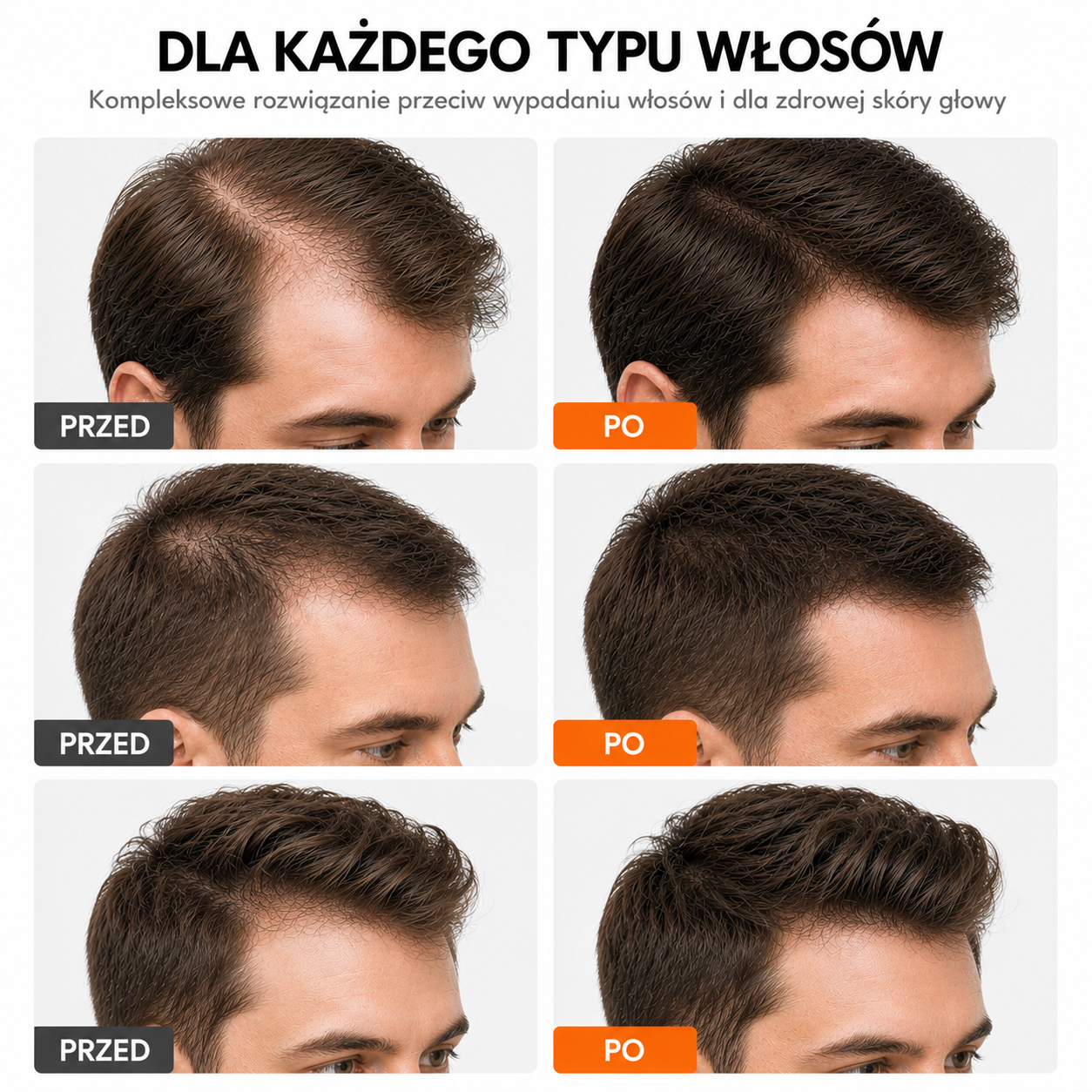 Koreańskie serum na porost włosów