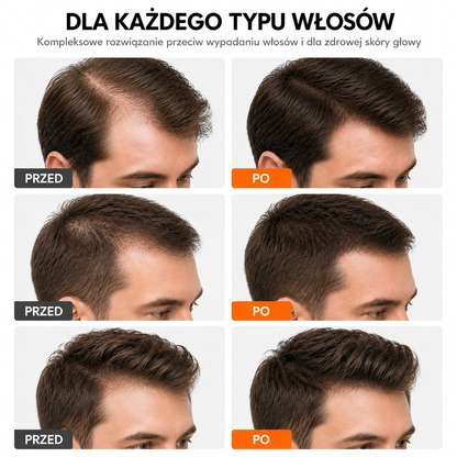 Koreańskie serum na porost włosów